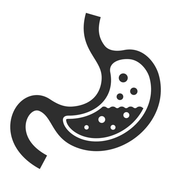 Gastro cirugía